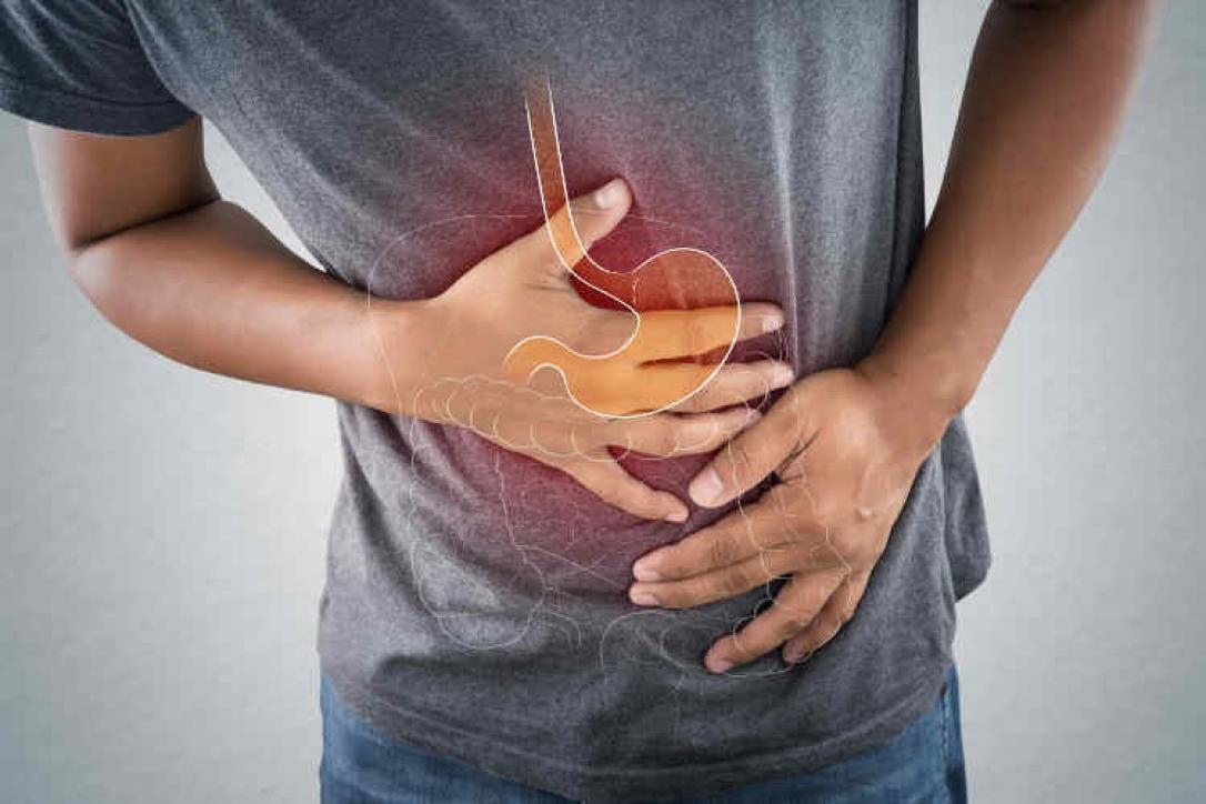 Crohn hastalığı: Nedenleri, Belirtileri ve Tedavisi